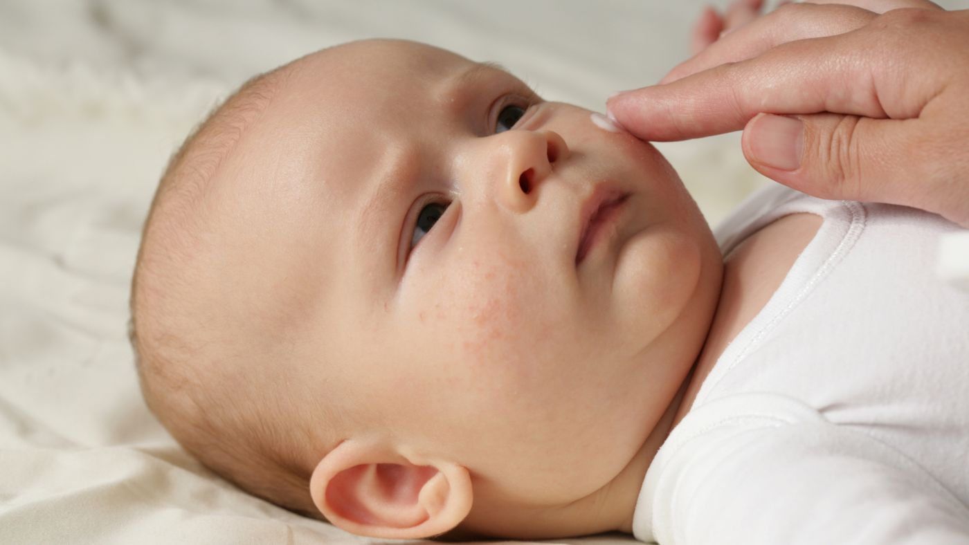 Mon bébé est allergique aux protéines de lait de vache : que dois-je savoir ?