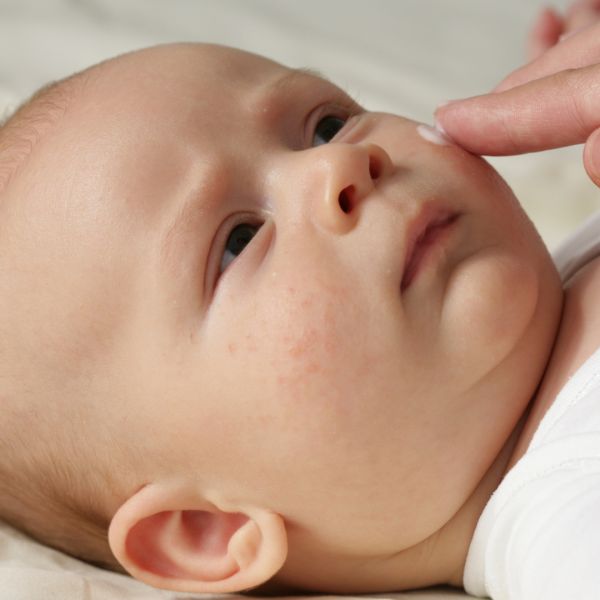 Mon bébé est allergique aux protéines de lait de vache : que dois-je savoir ?